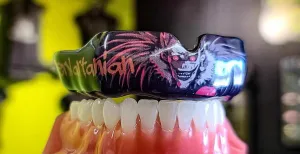 DC Mouthguards